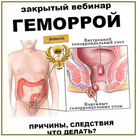Занятие Анальным Сексом При Геморрое Занятие Анальным Сексом При Геморрое
